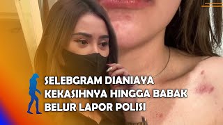 SIDOARJO - Selebgram Dianiaya Kekasihnya Hingga Babak Belur Lapor Polisi