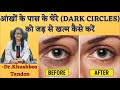 How To Get Rid Of Dark Circle (In Hindi) || By Dr. Khushboo Tandon