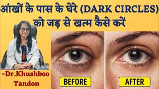 How To Get Rid Of Dark Circle (In Hindi) || By Dr. Khushboo Tandon screenshot 2