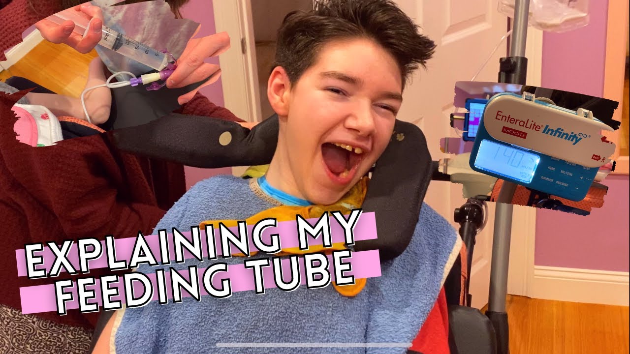 ALL ABOUT MY FEEDING TUBE How it works & Why I need it Special Needs