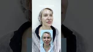 Не увеличивать губы, а делать более сочными