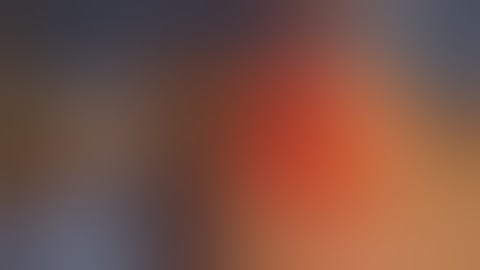 "Augmentation Mastopexy: Step-by-Step Surgical Technique Explained | Breast Lift + Implant Guide"