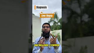 Wilson’s disease #highyieldmcq #usmleprep #step2ck