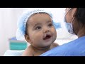 Cleft Lip Baby Awesome Transformation - Before & After Surgery