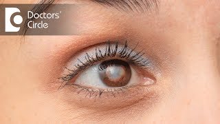 Which is the best Intraocular Lens suited for eyes? Dr. Samina F Zamindar