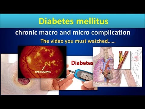 diabetes-mellitus(chronic-macro-and-micro-complication).