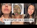 Как избавиться от прыщей / La roche posay effaclar / ХЕЛЕО4