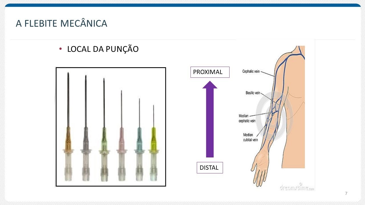FLEBITE: definição e classificação - YouTube