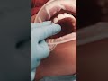 @primo_dental Client Review