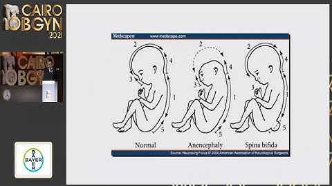 Cairo OBGYN 2021 - Dr. Amr Hassan