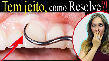 Como é o tratamento da doença periodontal?