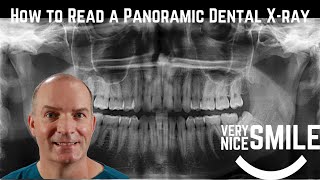 How to read a panoramic dental x ray by Very Nice Smile Dental 29,199 views 1 year ago 11 minutes, 19 seconds