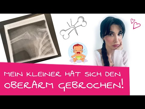 Video: Was Tun, Wenn Sich Ein Kind Im Kindergarten Verletzt?