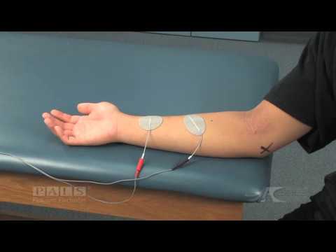 Position of the electrical muscle stimulation electrodes placed