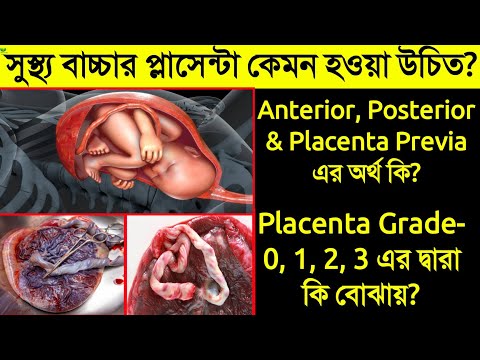 ভিডিও: একটি অগ্রগতি এবং একটি posteriori জ্ঞান কি?