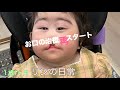【リンの日常】【1歳7ヶ月】お口の治療再スタート/口唇裂