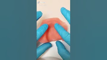 How to Make a Custom Impression Tray