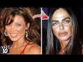 Top 10 Celebrities You Won't Recognize After Plastic Surgery - Part 3