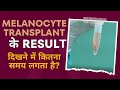 How long do melanocyte transplant outcomes take  care well medical centre