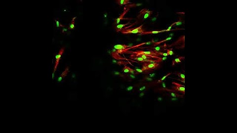 Cornea Fibroblasts on Sterile, Rehydrated, Lyophilized Collagen Gel (Confocal Microscopy)