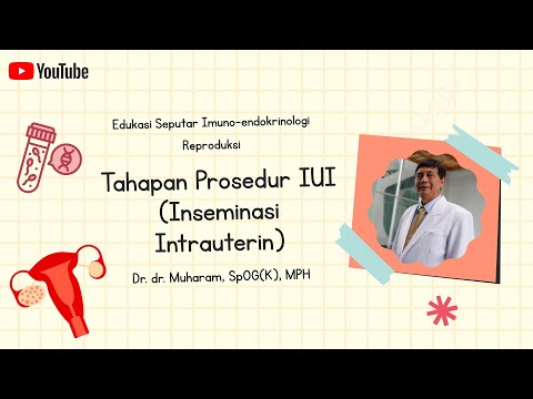 Video: Cara Mempersiapkan Inseminasi Intrauterin: 13 Langkah