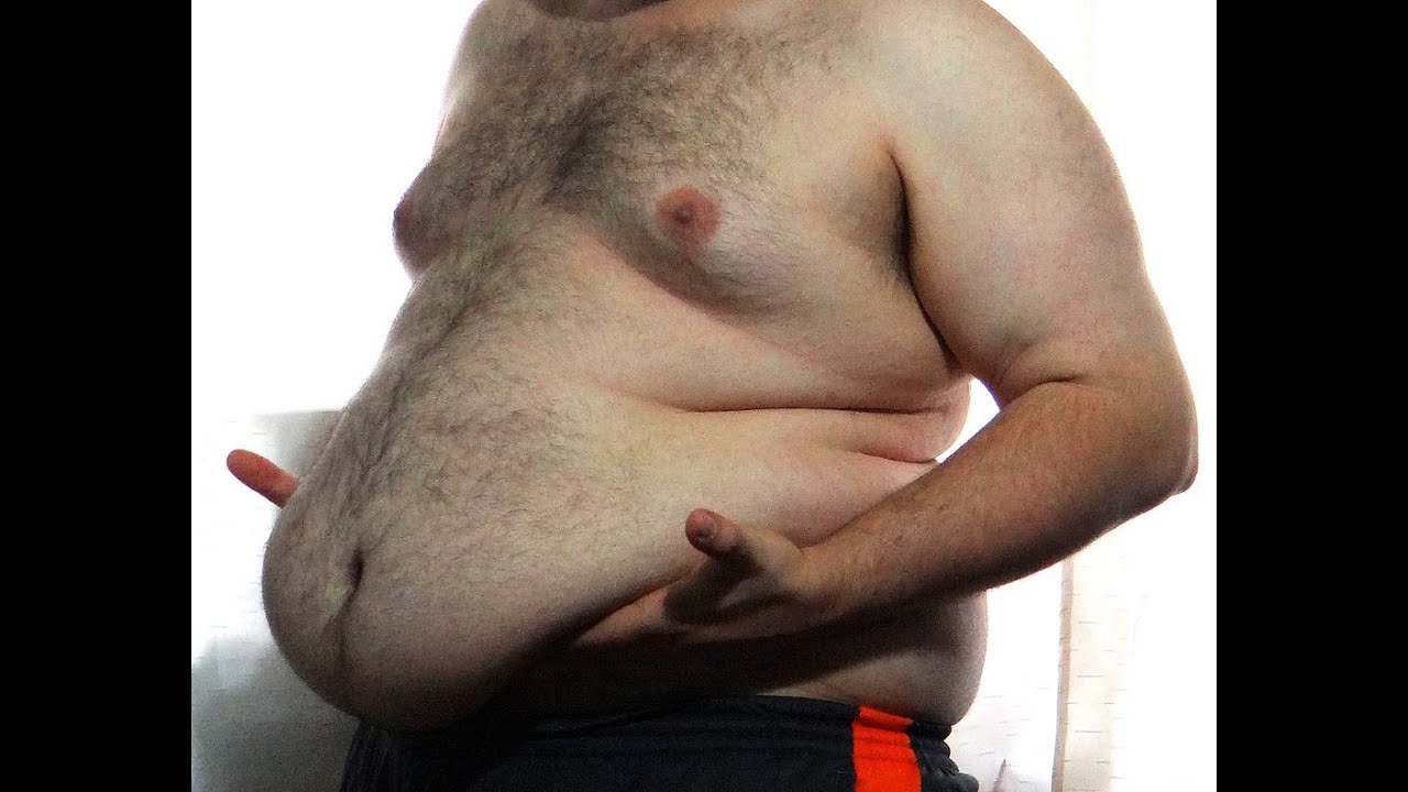 Толстый живот у мужчин. Морбидное ожирение ИМТ. Ожирение третьей степени (морбидное).