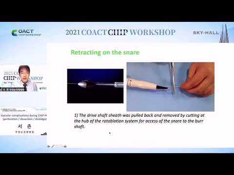 2021 COACT CHIP WORKSHOP 4 (SKY-hall) : when to go retrograde and tips for successful procedure 서 존