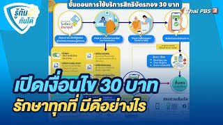 เปิดเงื่อนไข 30 บาท รักษาทุกที่ มีดีอย่างไร | รู้ทันกันได้