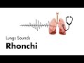 Rhonchi - Lung Sounds - Medzcool