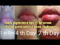 Lip serum for dark pigmented lips | 1 Week challenge | Home Remedy