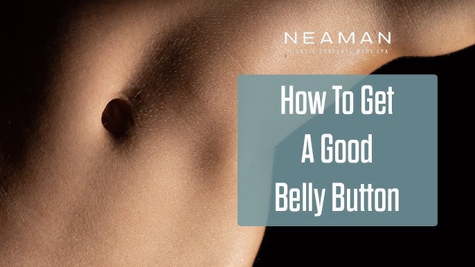 Belly Buttons  The Most Important Part of a Tummy Tuck 