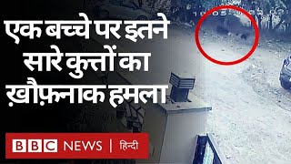 Dog Attack : Jaipur में कुत्तों ने बच्चे को दौड़ाया, घेरा, काटा और गंभीर रूप से घायल कर दिया (BBC) screenshot 4