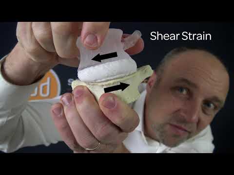 Shear Strain | Dynamic Disc Modeling