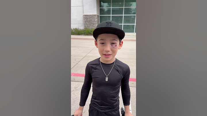 Took a bad baseball hop #shortstop #baseball #baseballlife #baseballlove #7yearsold #basebroz