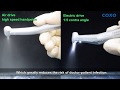 Why should dentists use electric dental handpiece as much as possible now?