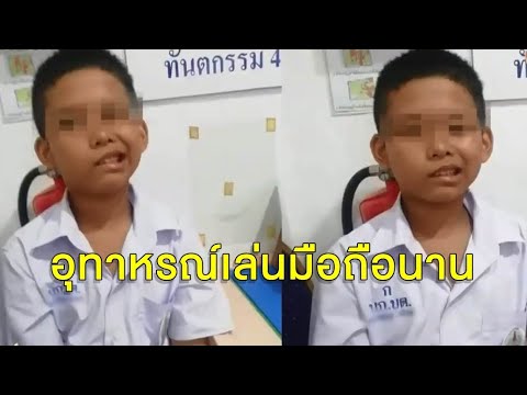 อุทาหรณ์ เด็กติดเล่นมือถือหนัก จนปลายประสาทอักเสบ หน้าเบี้ยว หมอเตือนผู้ใหญ่ก็เป็นได้