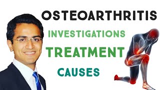 OSTEOARTHRITIS | SIGNS & SYMPTOMS | X RAY FINDINGS | OSTEOARTHRITIS TREATMENT | RISK FACTORS |