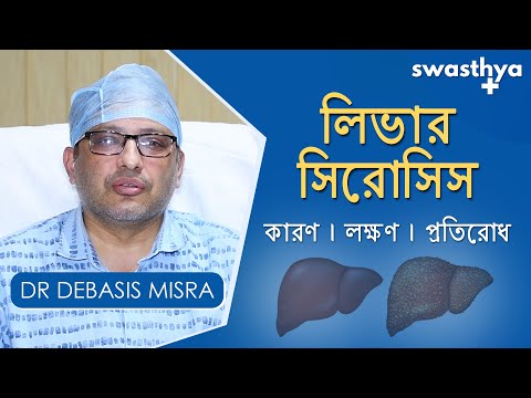 লিভার সিরোসিস - কারণ, লক্ষণ, প্রতিরোধ | Liver Cirrhosis in Bangla | Dr Debasis Misra