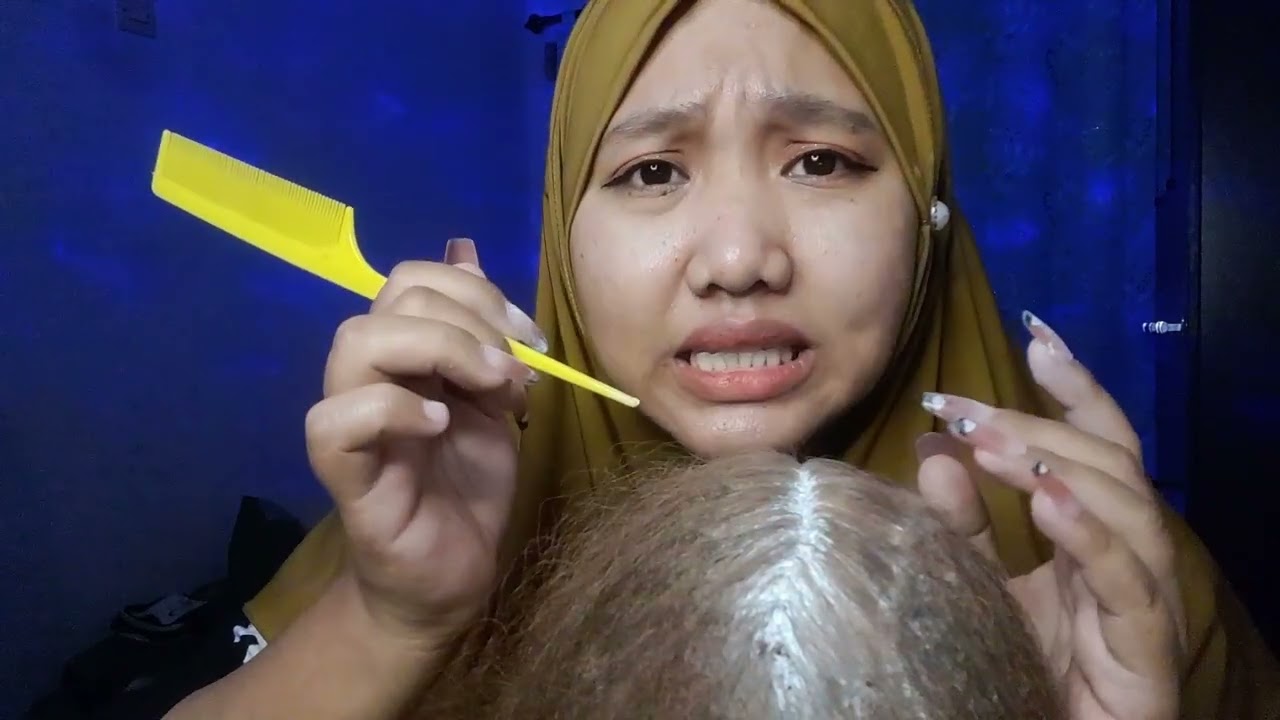 ASMR DANDRUFF || KETOMBE YANG BIKIN GATAL || RIKAA ASMR