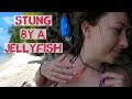 Stung By A Jellyfish - Cabagnow Cave Pool Bohol Philippines