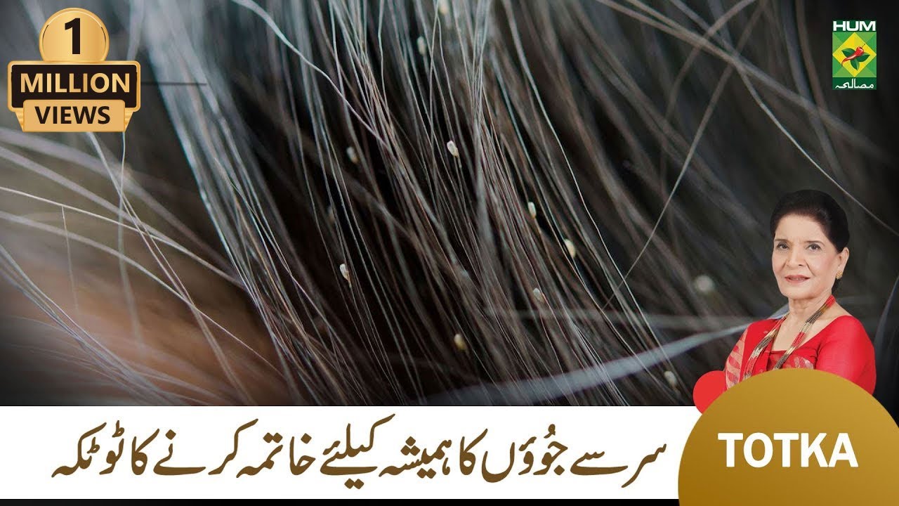 Zubaida Apa Totkay  Sar Ki Juen Khatam Karne Ka Tarika  Head Lice Removal  MasalaTv