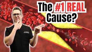 What is Heart Disease? The REAL Causes!
