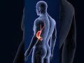 Symptoms of Stage 4 Esophageal Cancer