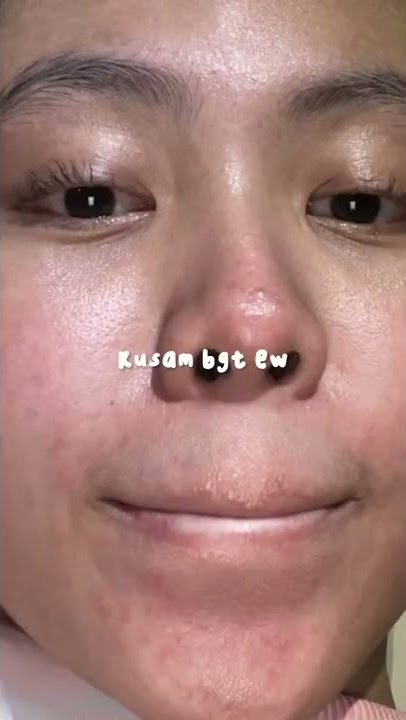 SLEEPING MASK ATASI SEMUA PERMASALAH WAJAH REMAJA CUMA 15 RIBU  LINK SHOPEE TERMURAH #SHORTS