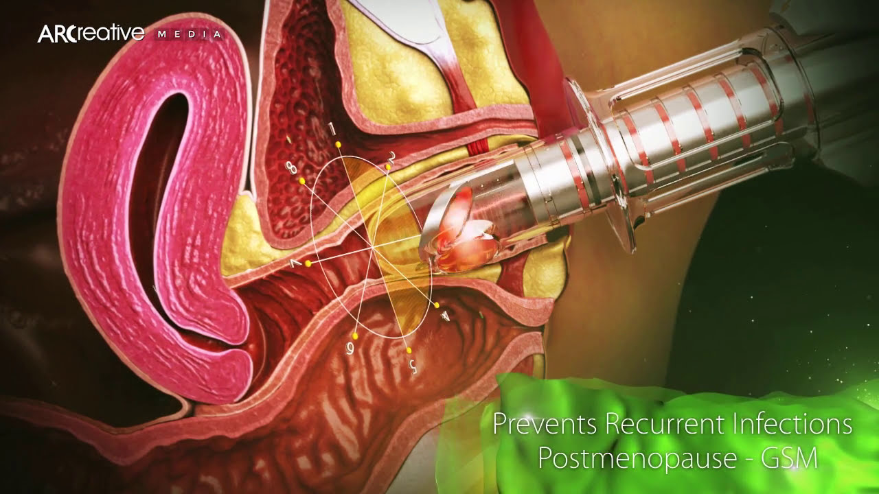 Rus yigitlari bilan tojik qiz seks Kavkaz porno bokira qizlar