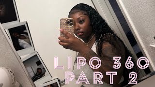 Lipo 360 part 2🫶🏾🌸 flight🌸food🌸preop 🌸hotel