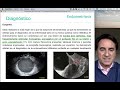 T41 Endometriosis. Adenomiosis. Dr Antonio Gosalvez