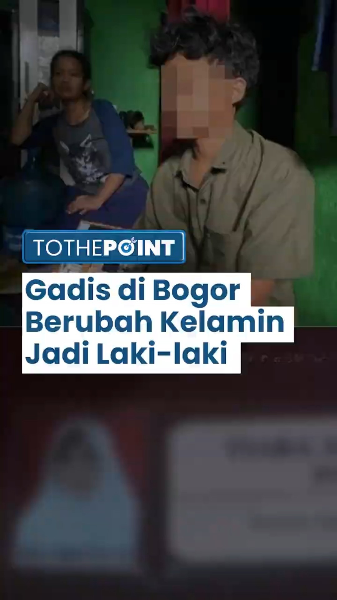 Kejadian Langka di Bogor, Seorang Remaja Alami Perubahan Jenis Kelamin dari Perempuan Jadi Laki-laki