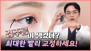 You have double wrinkles? | Director Kim Jin-tae of JT Plastic Surgery