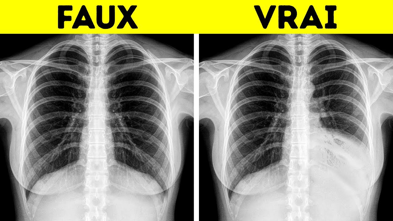 de-la-t-te-aux-pieds-secrets-et-mythes-incroyables-du-corps-humain
